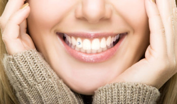 02-Tooth-Gems-Crazy-Beauty-Products-lifestyle