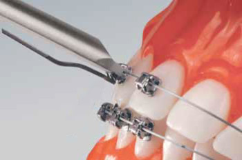 ortho_stages_2