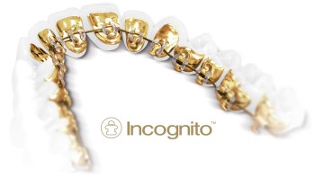 incognito_appliance