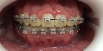 FullSizeRender (1)