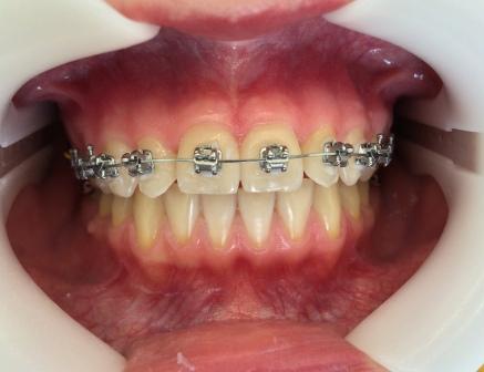 brek7nedel (1)