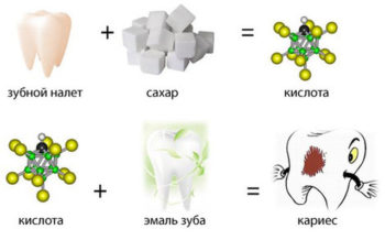 от чего появляется кариес