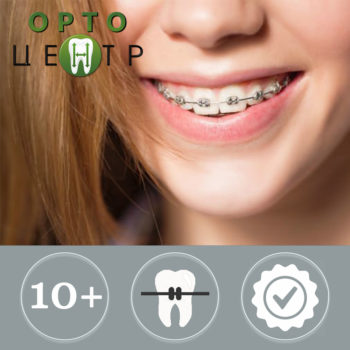 брекеты Саратов Орто Центр